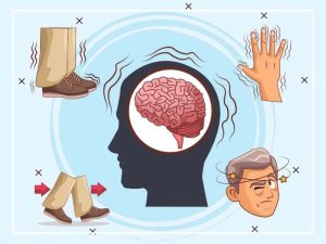 بیماری پارکینسون و کاردرمانی
