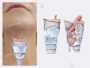 اختلالات صوت و مشکلات حنجره