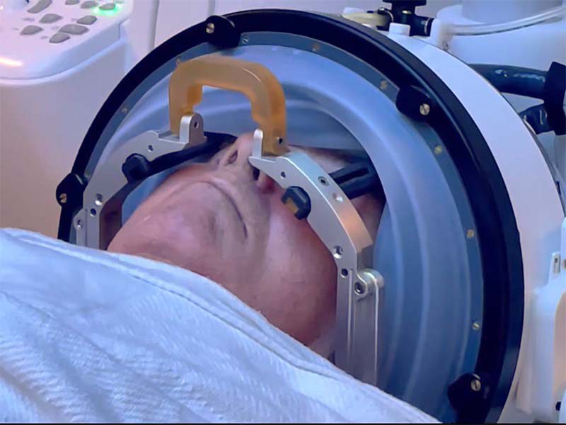 روش درمانی برای لرزش بیماران پارکینسون با امواج فراصوت متمرکز